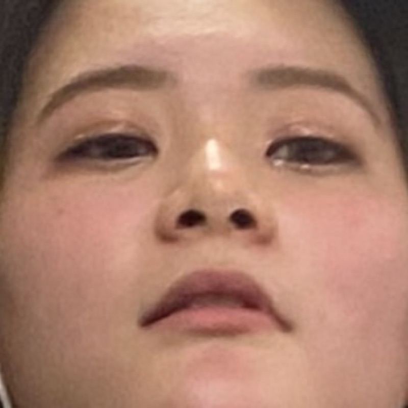 りん