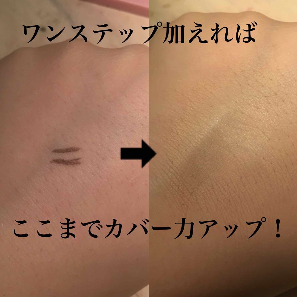 「濃いシミ・そばかすをカバーするコンシーラーの選び方&使い方は?厳選アイテム7選もご紹介!」の画像(#131206)