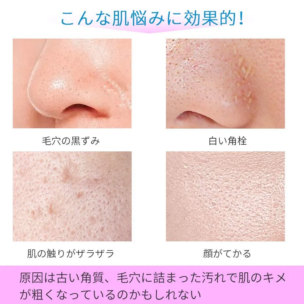 Tenntou Ultrasonic Facial Device Water Peeling Pore Care Exfoliation Care Tenntou Blackhead Keratin Plug Acne Skin Oil Stain Removal Firming Loose Skin Rechargeable Lightweight Overseas Use Helps Moisturizing Skin Penetrate Into Beauty