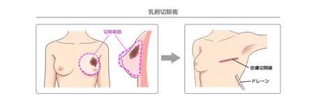 東京医科大学｜乳腺科公式ホームページ