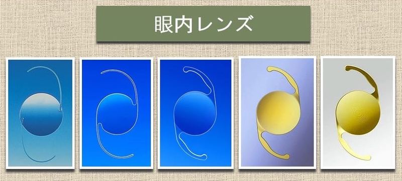 白内障の眼内レンズの種類 メディカルノート