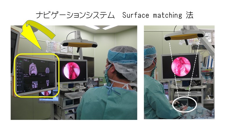 ナビゲーションシステム（旧式）：写真提供　澤津橋基広先生