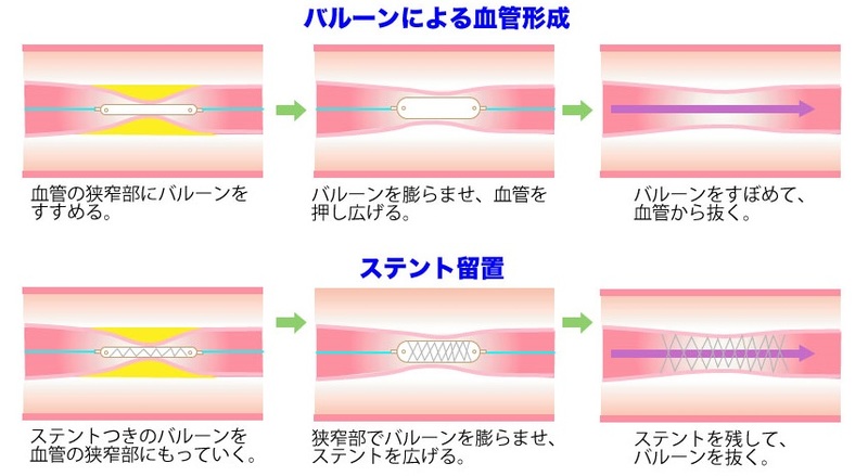 裁断済み　新PCI•カテーテル室のピンチからの脱出法 新 PCI・カテーテル室のピンチからの脱出法: 達人が教える119の