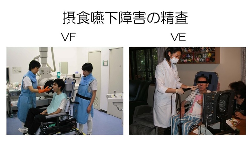 摂食嚥下障害の精査