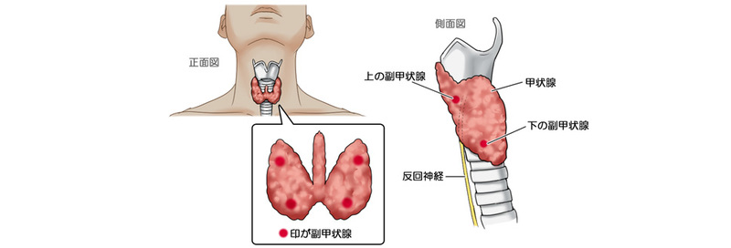 副甲状腺機能亢進症とは-副甲状腺ホルモンが過剰に分泌される病気 メディカルノート