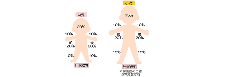熱傷面積算定法より