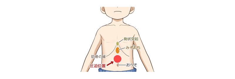 ハイムリック法詳細