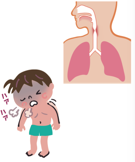 イラストを見せながら説明する子どもの病気とその診かた イラストを見せながら説明する 子どもの病気とその診かた | 金子