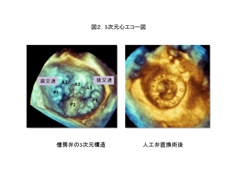 虚血性心疾患の最新診断技術：心エコー、CTやアイソトープを使った痛み