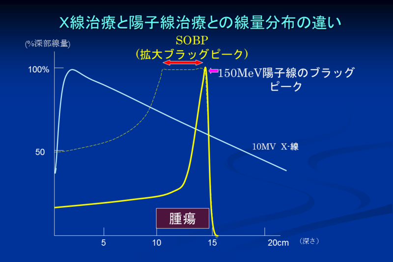 X線治療と粒子線治療（陽子線）の線量分布の違い