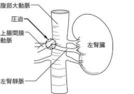 ナイトクラッカー現象の仕組み