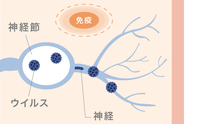 免疫が弱くなると神経節に潜伏感染していた水痘帯状疱疹ウイルスが再活性化する