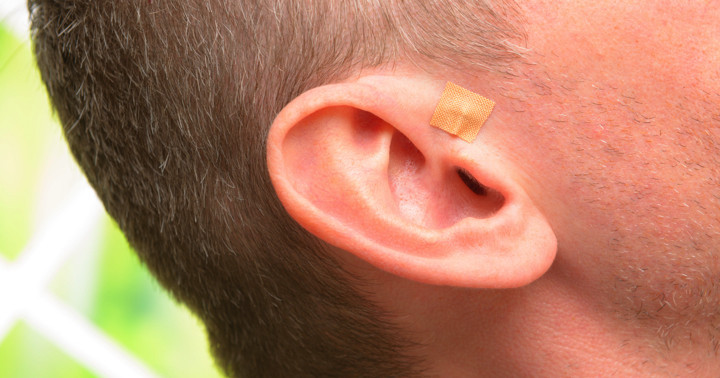 特殊な鍼を使って自分で耳を刺激するとアレルギー性鼻炎が改善する？ の写真