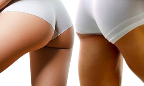 Translation missing: ja.board.image.alt.https: