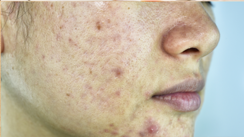 Translation missing: ja.board.image.alt.https: