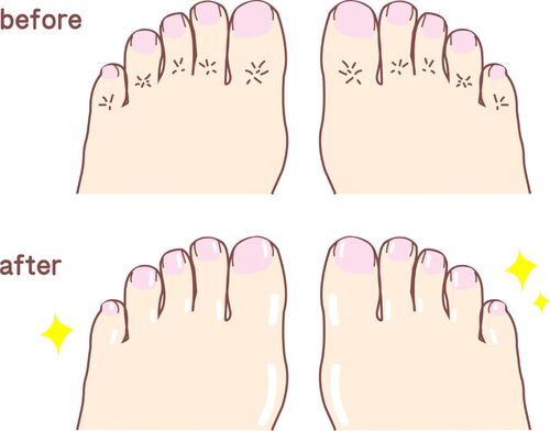 Translation missing: ja.board.image.alt.https: