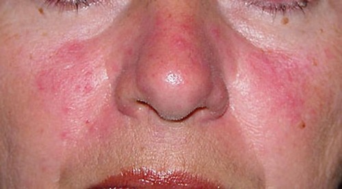 Translation missing: ja.board.image.alt.https: