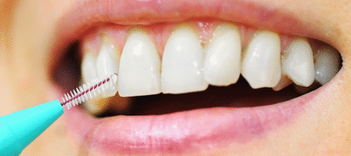 Translation missing: ja.board.image.alt.https: