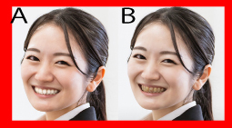 Translation missing: ja.board.image.alt.https: