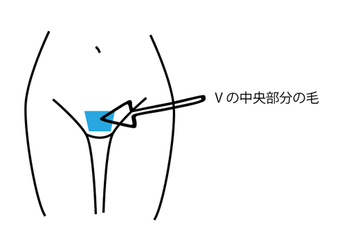 Translation missing: ja.board.image.alt.https: