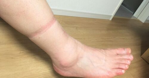 Translation missing: ja.board.image.alt.https: