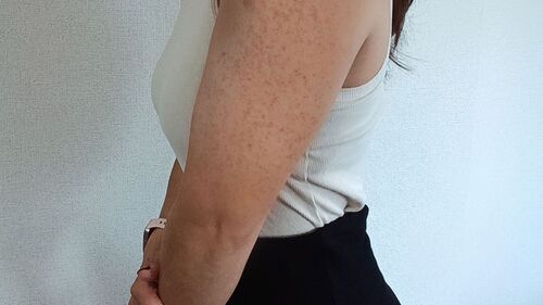 Translation missing: ja.board.image.alt.https: