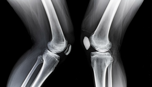 Translation missing: ja.board.image.alt.https: