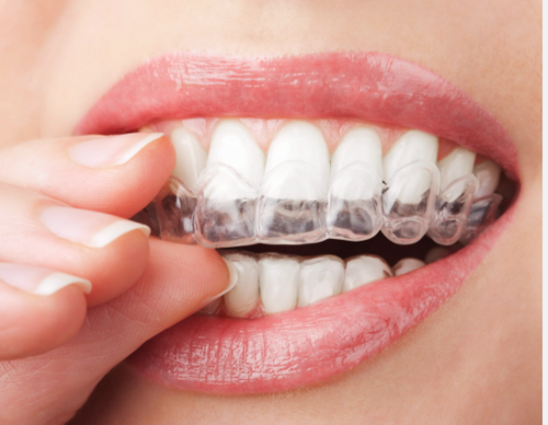 Translation missing: ja.board.image.alt.https: