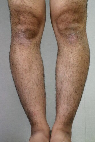 Translation missing: ja.board.image.alt.https: