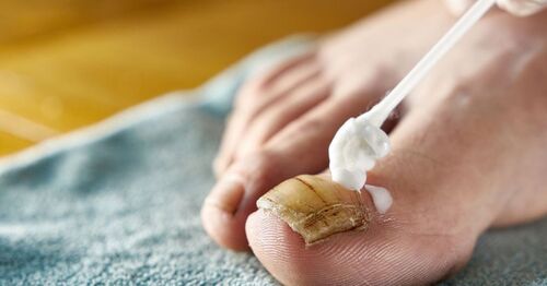 靴に関するアイデア募集