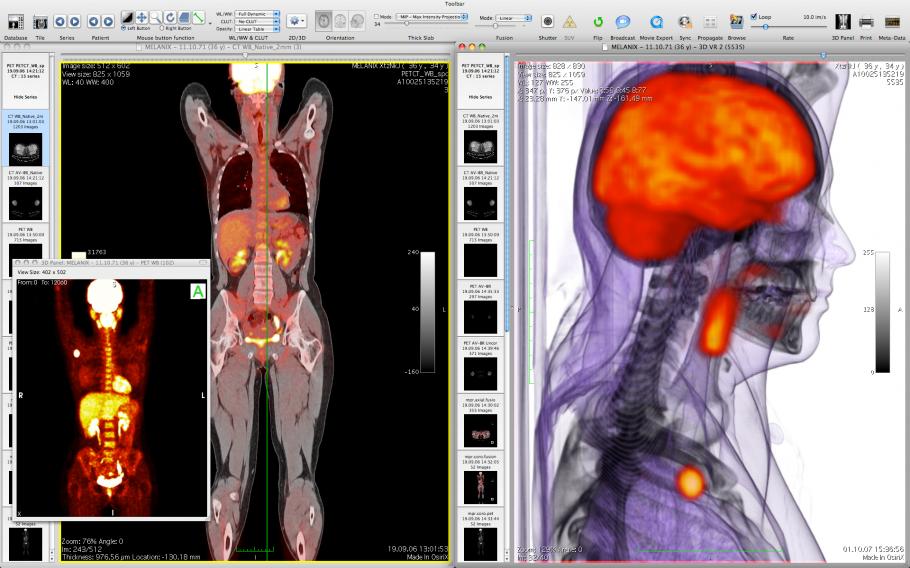 Codonics Clarity Viewer For Mac [UPD] Peatix