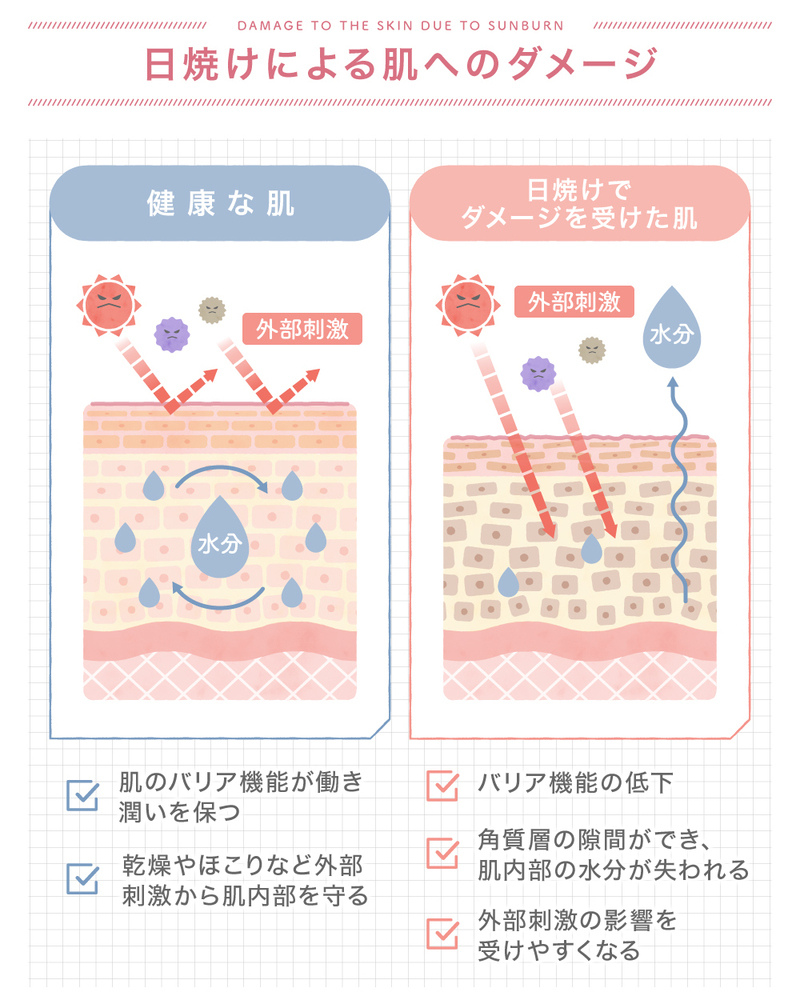 顔脱毛中の日焼けがダメな理由は？