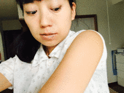 B.C.G.の画像