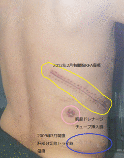傷痕の画像