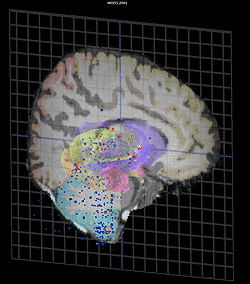 アレン脳科学研究所の画像