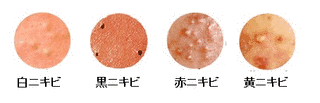 黄法クの画像