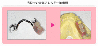 スズの化合物の画像