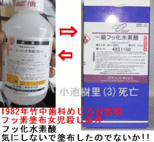 八王子市歯科医師フッ化水素酸誤塗布事故の画像