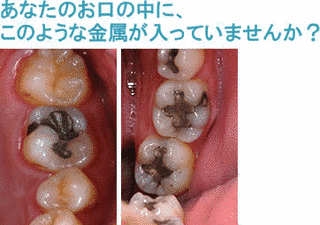 水銀の化合物の画像