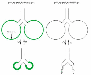 肺サーファクタントの画像