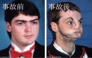 リー・ノリスの画像