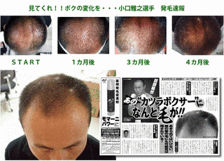 小口雅之の画像