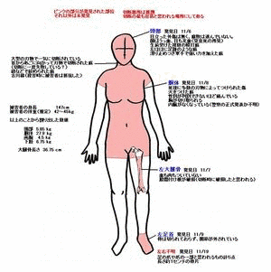島根女子大生死体遺棄事件の画像