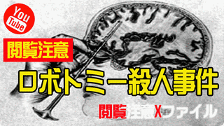 ロボトミー殺人事件の画像
