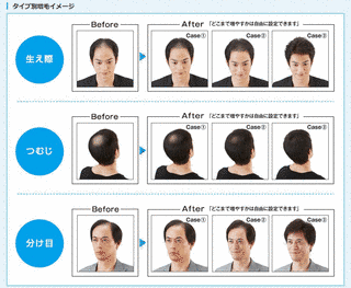 アートネイチャーの画像