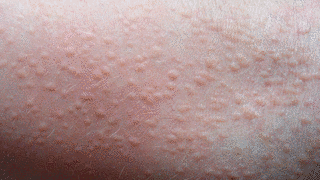 RASH!!の画像