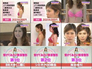 アンテナ22の画像