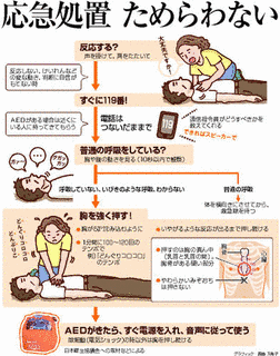 心室細動の画像