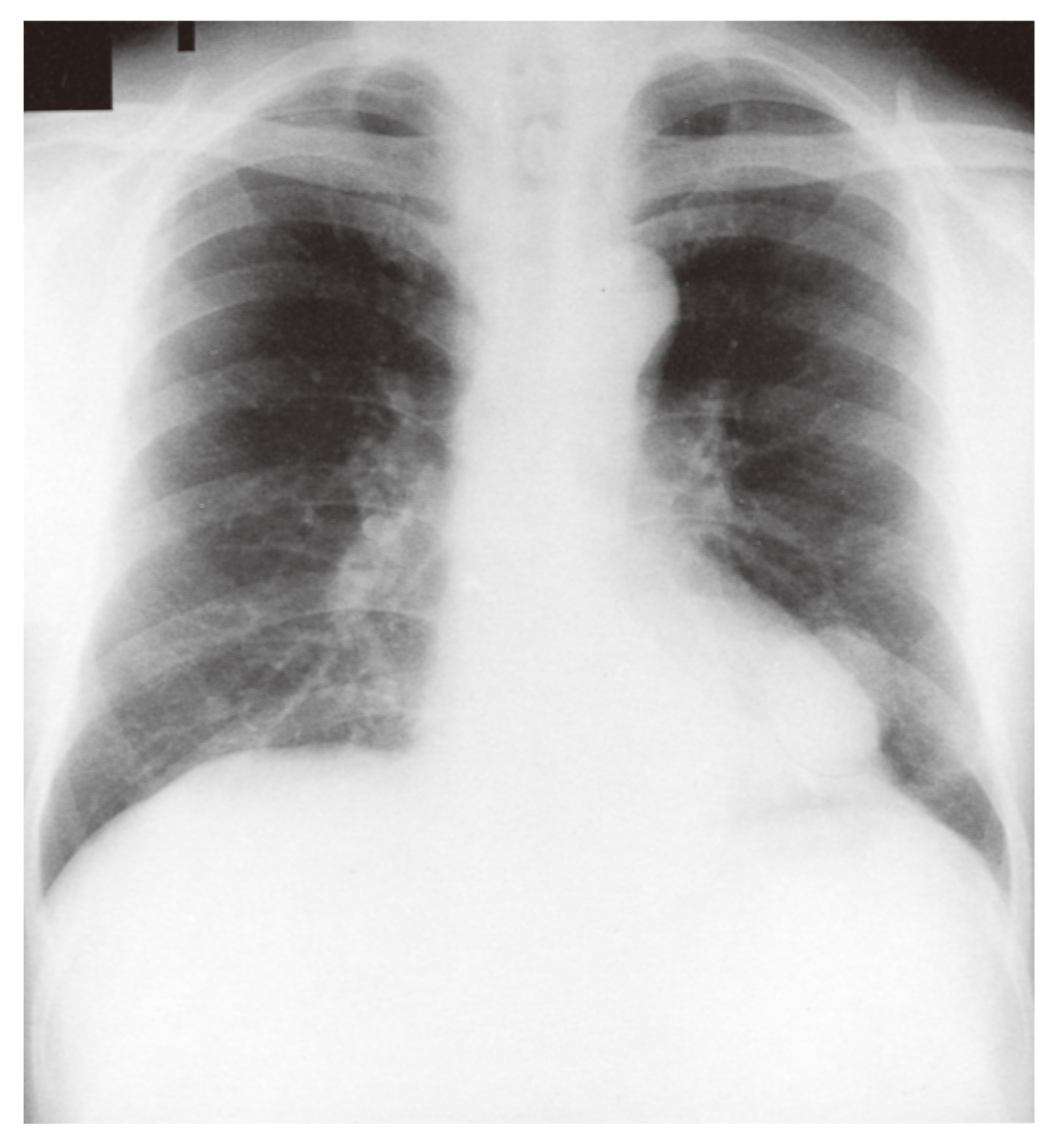 お歳暮・冬ギフト特集2024 国試 胸部エックス線 | 87A87 | Medical M3E 医学一般