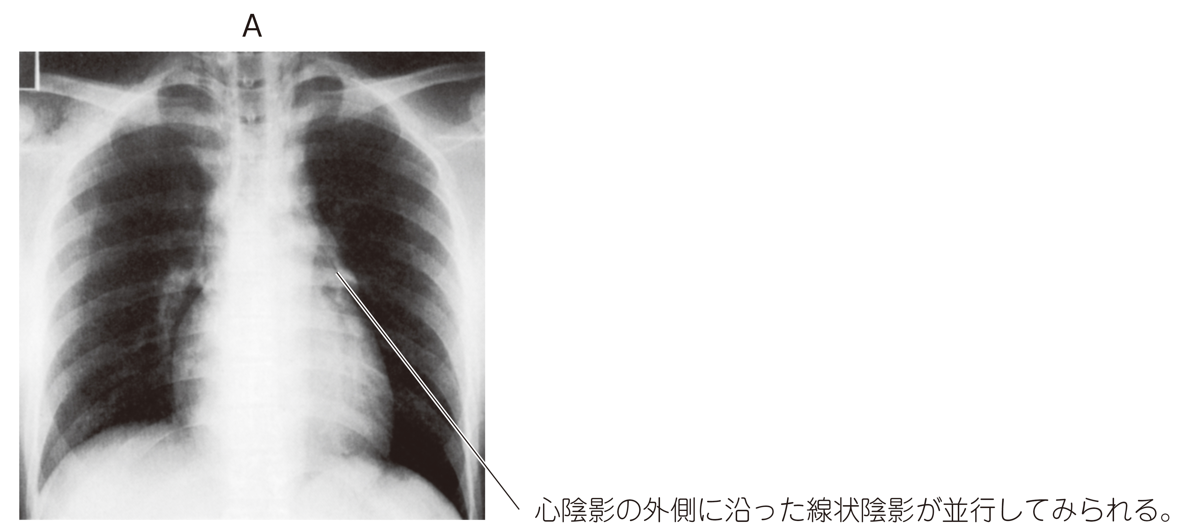99H7 | 頸部外傷・損傷 国試 | テコプラ
